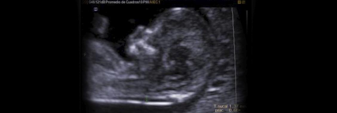 DIAGNÓSTICO AVANZADO DE MALFORMACIÓN FETAL